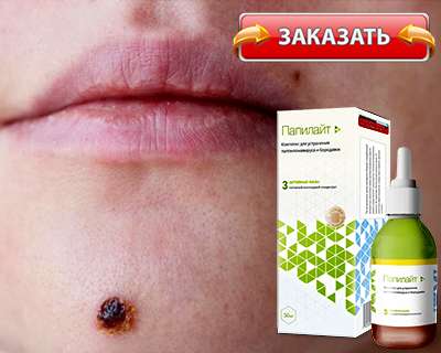 Купить папилайт