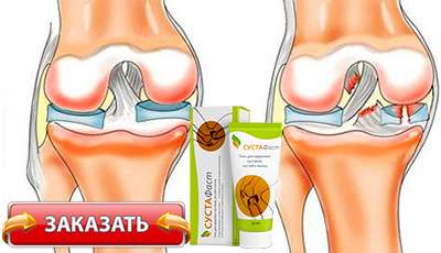 Сустафаст купить в аптеке