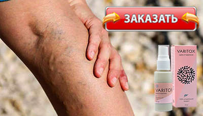 Варитокс купить в аптеке.