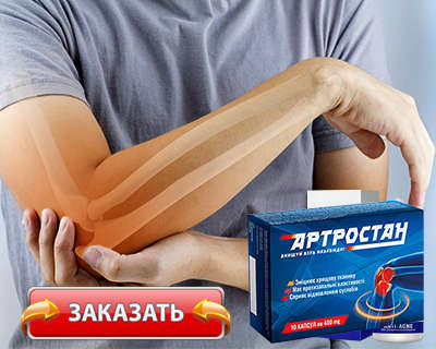 Препарат Артростан купить по доступной цене.